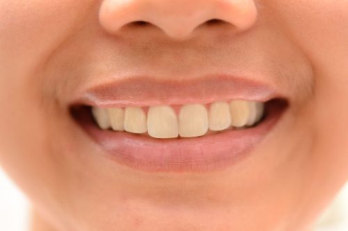 Get-Perfect-Teeth-Step-11-758x505