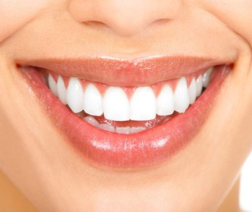 Rectangular-teeth-608x512